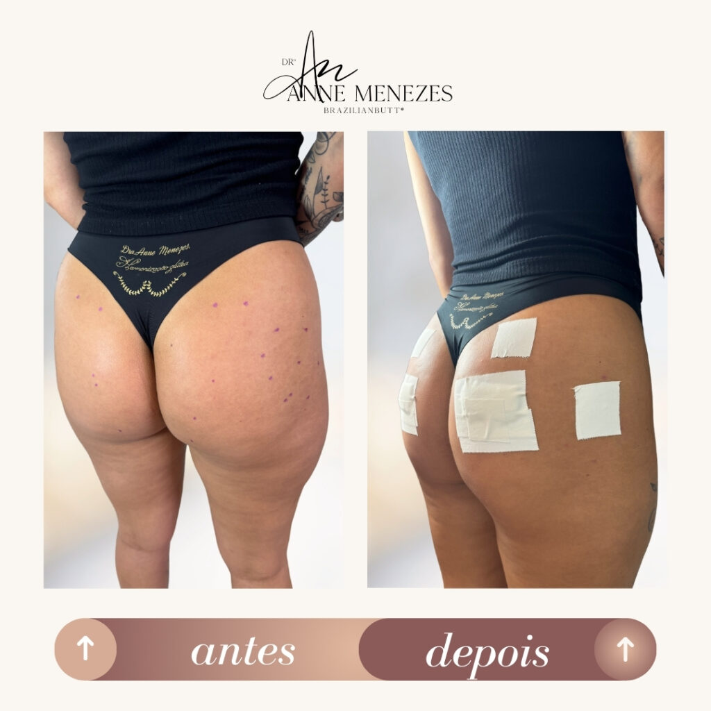 antes-e-depois-1